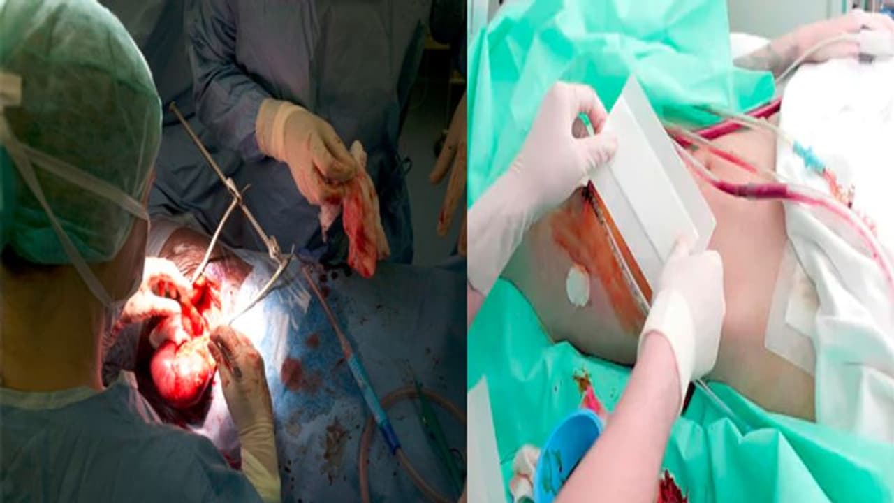 విశాఖలో కిడ్నీ రాకెట్: త్రిసభ్య కమిటీ ఏర్పాటు విశాఖలో కిడ్నీ రాకెట్: త్రిసభ్య కమిటీ ఏర్పాటు