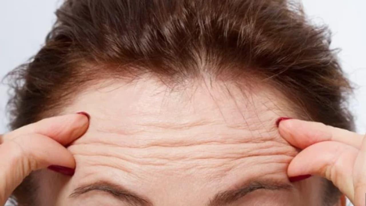 നെറ്റിയിലെ ചുളിവും ഹൃദയവും തമ്മിലുള്ള ബന്ധമിതാണ്... നെറ്റിയിലെ ചുളിവും ഹൃദയവും തമ്മിലുള്ള ബന്ധമിതാണ്...