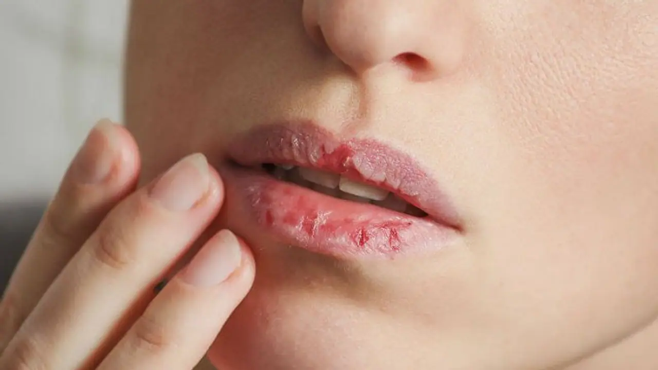 Lips: குளிர்கால வெடிப்பு, புண், தோல் உரிதலில் இருந்து உதடுகளை பாதுகாக்க... சிம்பிள் 5 டிப்ஸ் இருக்கு...!! Lips: குளிர்கால வெடிப்பு, புண், தோல் உரிதலில் இருந்து உதடுகளை பாதுகாக்க... சிம்பிள் 5 டிப்ஸ் இருக்கு...!!