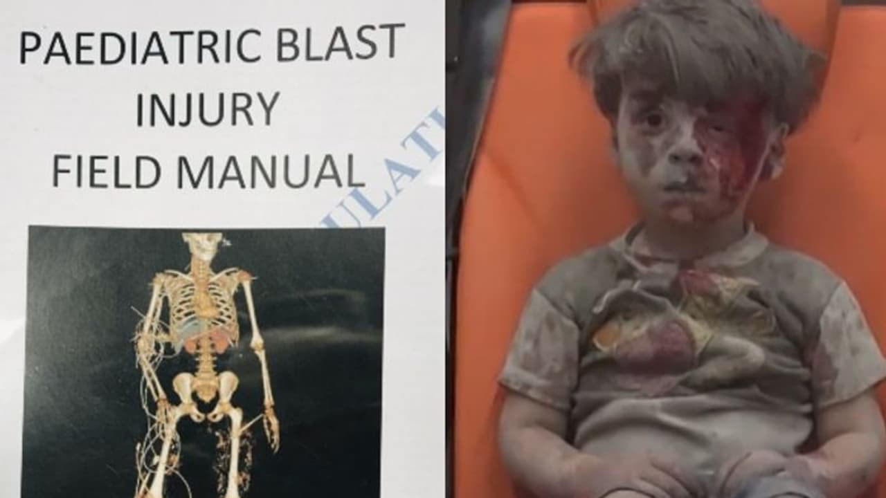 യുദ്ധം കുഞ്ഞുങ്ങളോട് ചെയ്യുന്നത്... ആ കുഞ്ഞുങ്ങളെ പരിചരിക്കേണ്ടതെങ്ങനെ; ആദ്യമായി പുസ്തകമിറങ്ങുന്നു യുദ്ധം കുഞ്ഞുങ്ങളോട് ചെയ്യുന്നത്... ആ കുഞ്ഞുങ്ങളെ പരിചരിക്കേണ്ടതെങ്ങനെ; ആദ്യമായി പുസ്തകമിറങ്ങുന്നു