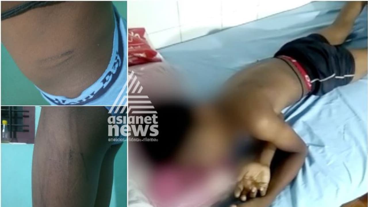 മോഷണമാരോപിച്ച് പൊന്നാനിയില് 14 വയസുകാരന് ക്രൂരമര്ദ്ദനം; വിവസ്ത്രനാക്കി ചിത്രമെടുത്തെന്നും പരാതി മോഷണമാരോപിച്ച് പൊന്നാനിയില് 14 വയസുകാരന് ക്രൂരമര്ദ്ദനം; വിവസ്ത്രനാക്കി ചിത്രമെടുത്തെന്നും പരാതി