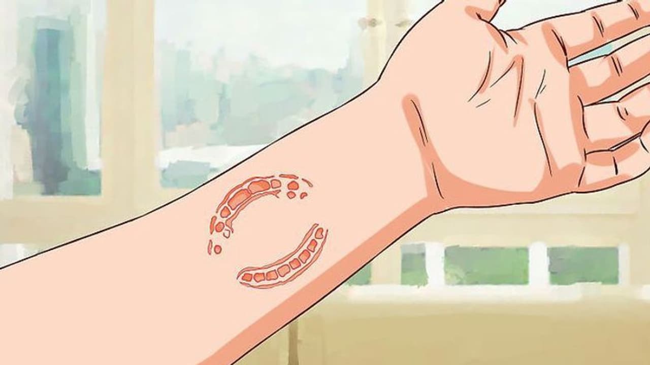 മനുഷ്യര് കടിക്കുന്നത്, മൃഗങ്ങളുടെ കടിയോളം അപകടമാണോ? മനുഷ്യര് കടിക്കുന്നത്, മൃഗങ്ങളുടെ കടിയോളം അപകടമാണോ?