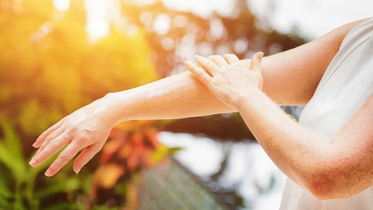 গরমে ঘামাচির সমস্যায় নাজেহাল? রইল ঘরোয়া সমাধান গরমে ঘামাচির সমস্যায় নাজেহাল? রইল ঘরোয়া সমাধান