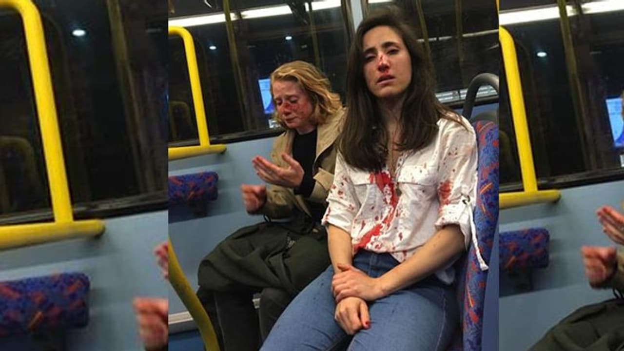 പരസ്യമായി ചുംബിക്കാന് വിസമ്മതിച്ചു; 'ലെസ്ബിയന്' പെണ്കുട്ടികള്ക്ക് ബസ്സില് ക്രൂരമര്ദ്ദനം പരസ്യമായി ചുംബിക്കാന് വിസമ്മതിച്ചു; 'ലെസ്ബിയന്' പെണ്കുട്ടികള്ക്ക് ബസ്സില് ക്രൂരമര്ദ്ദനം