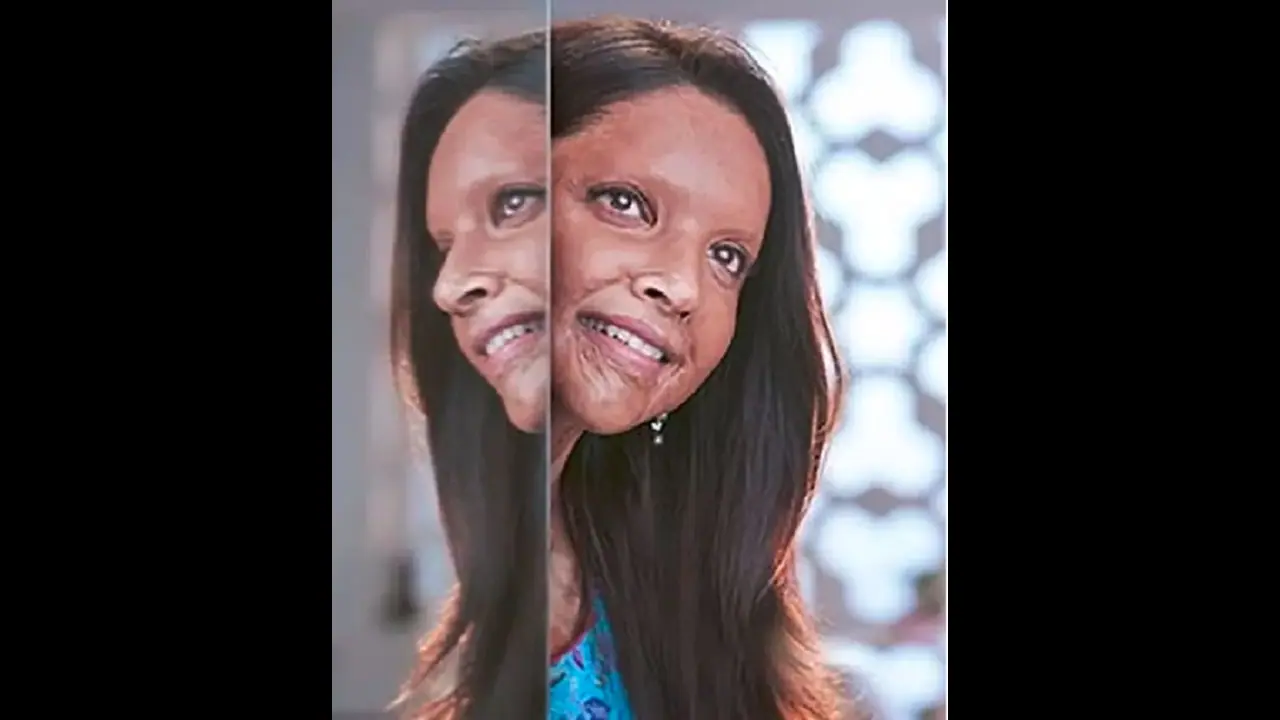 ছবির পোস্টারে অ্যাসিড আক্রান্ত দীপিকার মুখ, কীভাবে ফুটিয়ে তুললেন নায়িকা, জানালেন পরিচালক ছবির পোস্টারে অ্যাসিড আক্রান্ত দীপিকার মুখ, কীভাবে ফুটিয়ে তুললেন নায়িকা, জানালেন পরিচালক