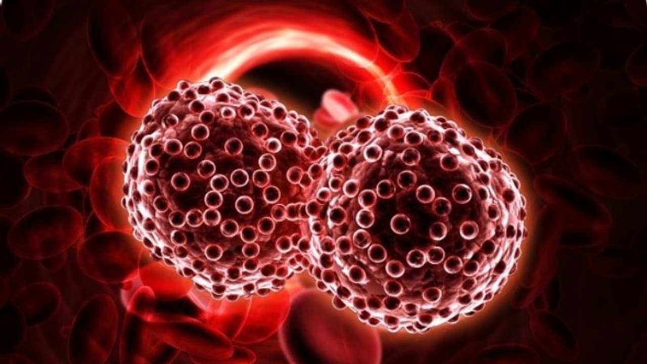 ബ്ലഡ് ക്യാന്സര്; അറിയാം പ്രാരംഭ ലക്ഷണങ്ങള് ബ്ലഡ് ക്യാന്സര്; അറിയാം പ്രാരംഭ ലക്ഷണങ്ങള്