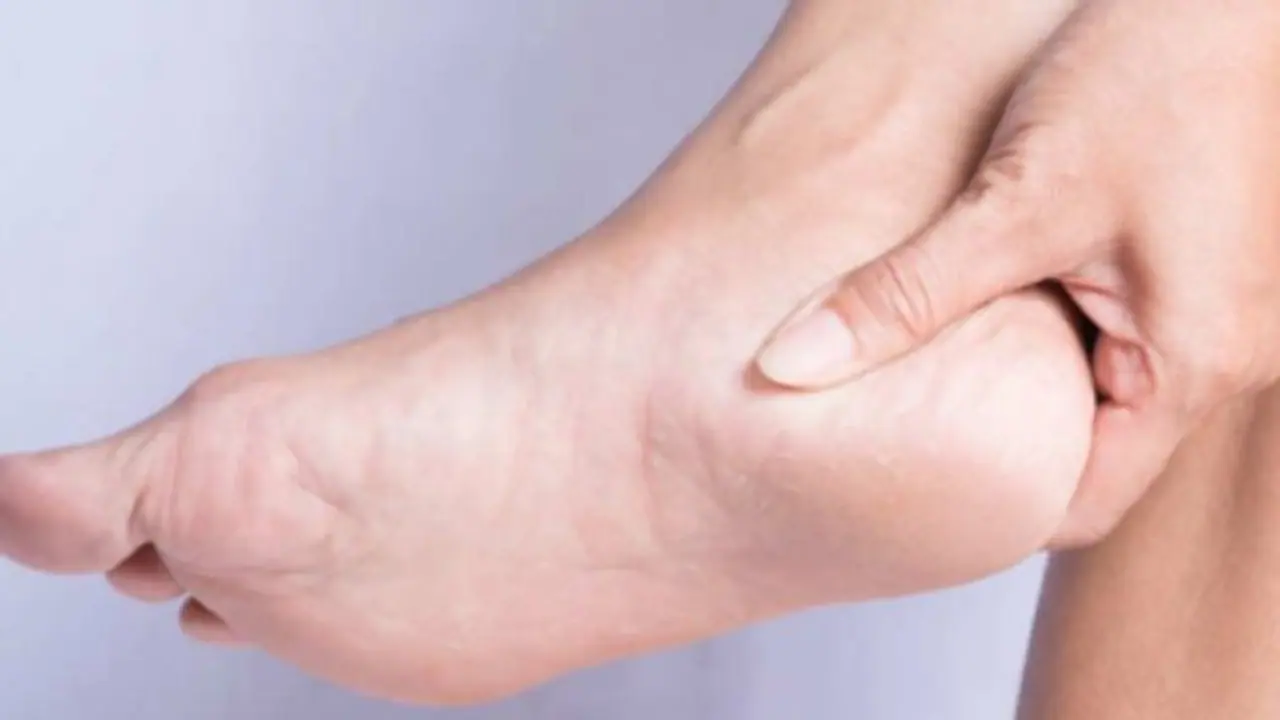 பாத வெடிப்பு வராமல் முற்றிலும் தடுக்க சூப்பர் ஐடியா இதோ...! பாத வெடிப்பு வராமல் முற்றிலும் தடுக்க சூப்பர் ஐடியா இதோ...!