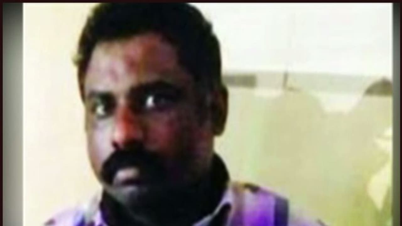 റിമാന്ഡ് പ്രതി മരിച്ച സംഭവം; രാജ്കുമാറിന്റെ മൃതദേഹത്തിൽ ചതവുണ്ടെന്ന് പോസ്റ്റുമോര്ട്ടം റിപ്പോര്ട്ട് റിമാന്ഡ് പ്രതി മരിച്ച സംഭവം; രാജ്കുമാറിന്റെ മൃതദേഹത്തിൽ ചതവുണ്ടെന്ന് പോസ്റ്റുമോര്ട്ടം റിപ്പോര്ട്ട്