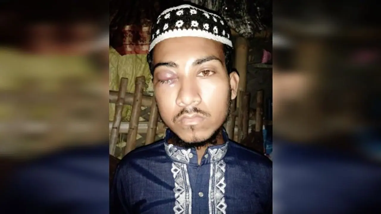 কলকাতাতেই শিক্ষককে বেদম মার, দাবি 'জয় শ্রীরাম' বলতে হবে, মুখ খুললেন শাহরুফ কলকাতাতেই শিক্ষককে বেদম মার, দাবি 'জয় শ্রীরাম' বলতে হবে, মুখ খুললেন শাহরুফ