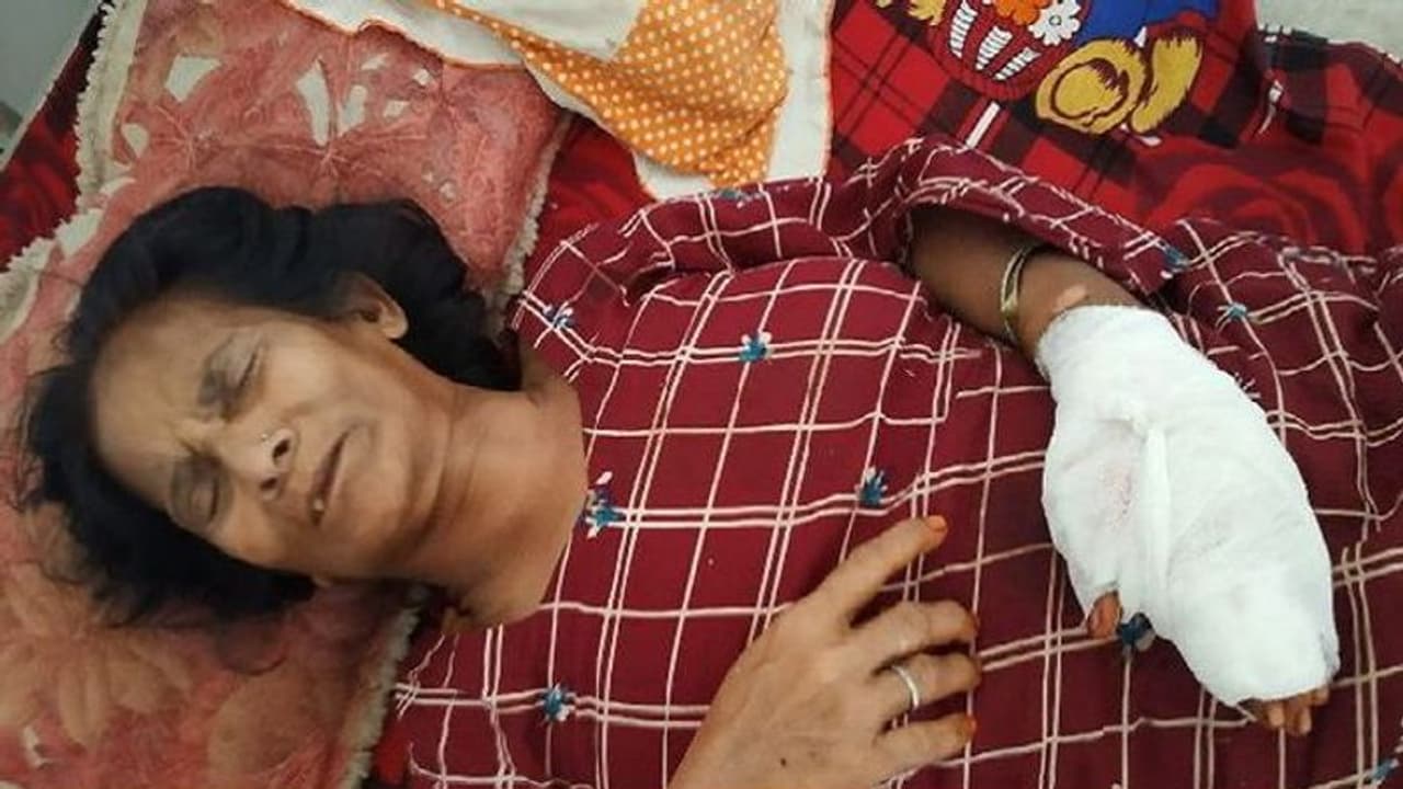 महिला को अकेला पाकर डोल गई भिखारियों की नीयत, लूटपाट के बाद इतना पीटा कि लगाने पड़े 100 टांके महिला को अकेला पाकर डोल गई भिखारियों की नीयत, लूटपाट के बाद इतना पीटा कि लगाने पड़े 100 टांके