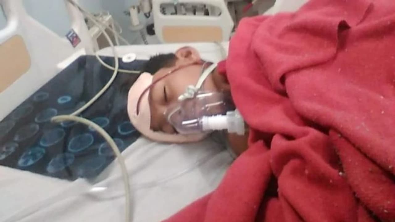 ക്ലാസിലെ ഫാൻ തകർന്ന് തലയിൽ വീണ് ഏഴാം ക്ലാസ് വിദ്യാർത്ഥിക്ക് ഗുരുതര പരിക്ക് ക്ലാസിലെ ഫാൻ തകർന്ന് തലയിൽ വീണ് ഏഴാം ക്ലാസ് വിദ്യാർത്ഥിക്ക് ഗുരുതര പരിക്ക്