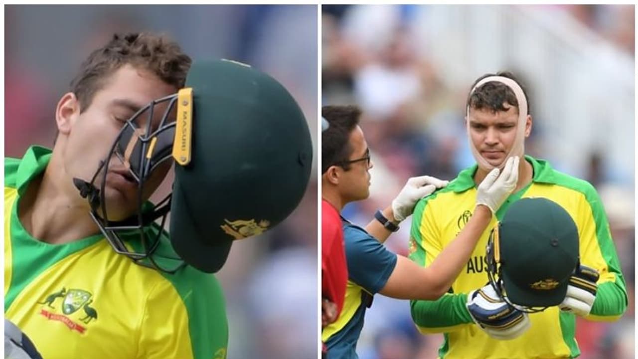 ആര്ച്ചറുടെ ബൗണ്സറില് ഹെല്മറ്റ് തെറിച്ചു; പരിക്കേറ്റ ക്യാരി കളിക്കുന്നത് ബാന്ഡേജുമായി ആര്ച്ചറുടെ ബൗണ്സറില് ഹെല്മറ്റ് തെറിച്ചു; പരിക്കേറ്റ ക്യാരി കളിക്കുന്നത് ബാന്ഡേജുമായി