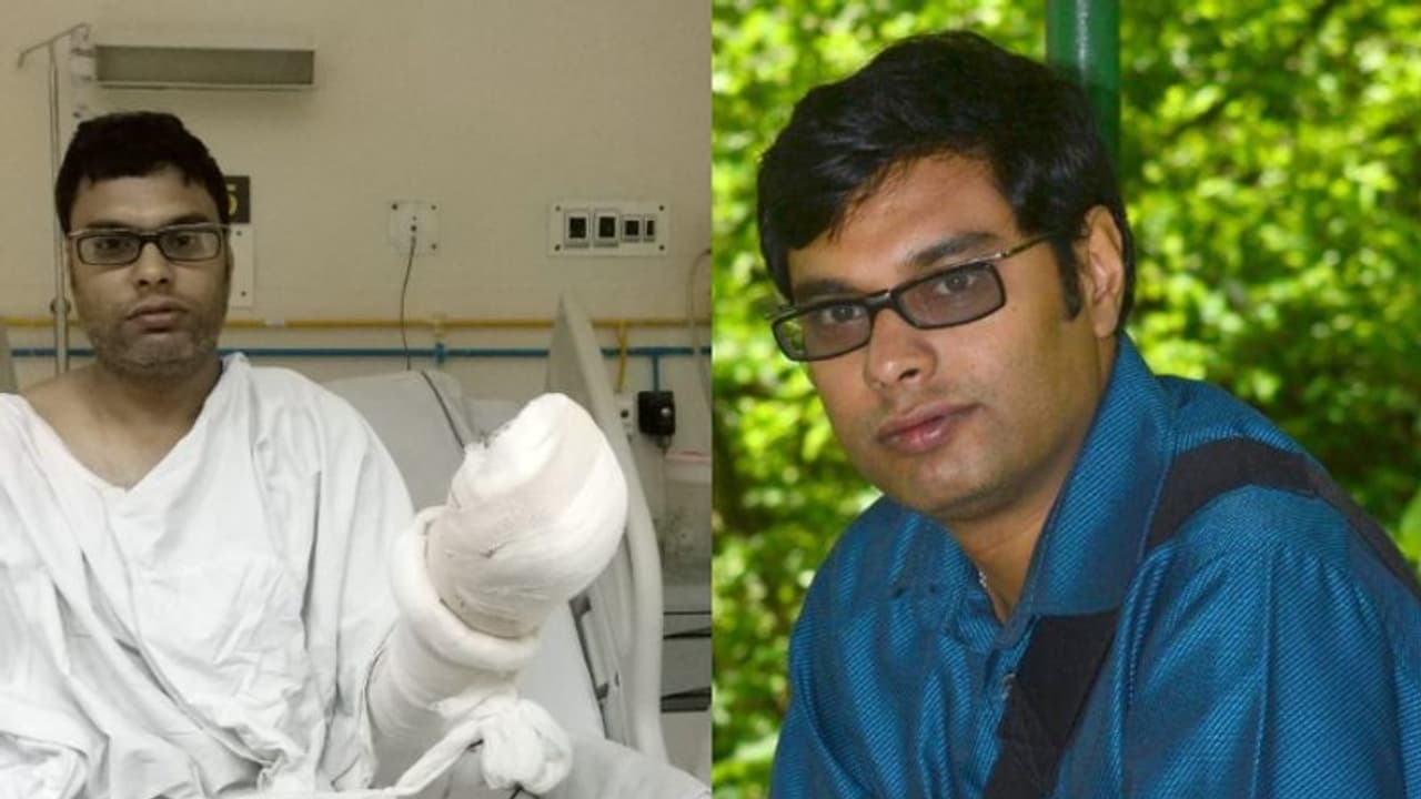 হারিয়ে গেল কাটা আঙুল, বদলে গেল নামী হাসপাতালের বয়ানও