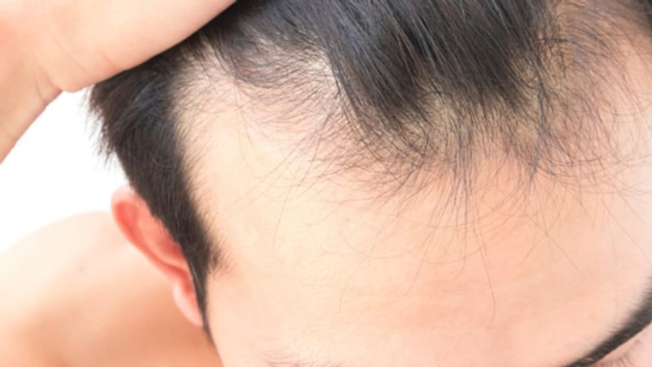 আপনার এই ৬ ভুলের কারণে পাতলা হয়ে যেতে পারে চুলের গোড়া আপনার এই ৬ ভুলের কারণে পাতলা হয়ে যেতে পারে চুলের গোড়া