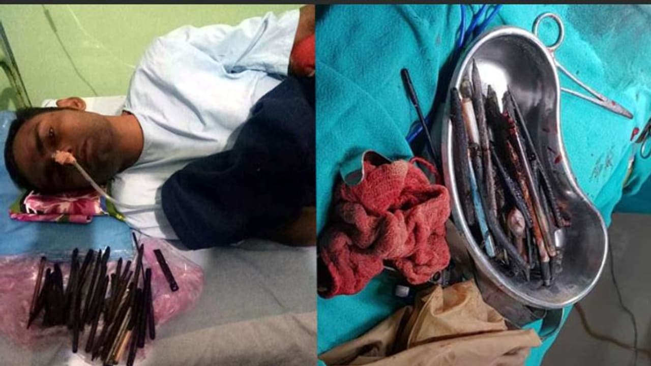 पेट है या कबाड़खाना: अंदर पड़ी मिलीं 50 तरह की चीजें पेट है या कबाड़खाना: अंदर पड़ी मिलीं 50 तरह की चीजें