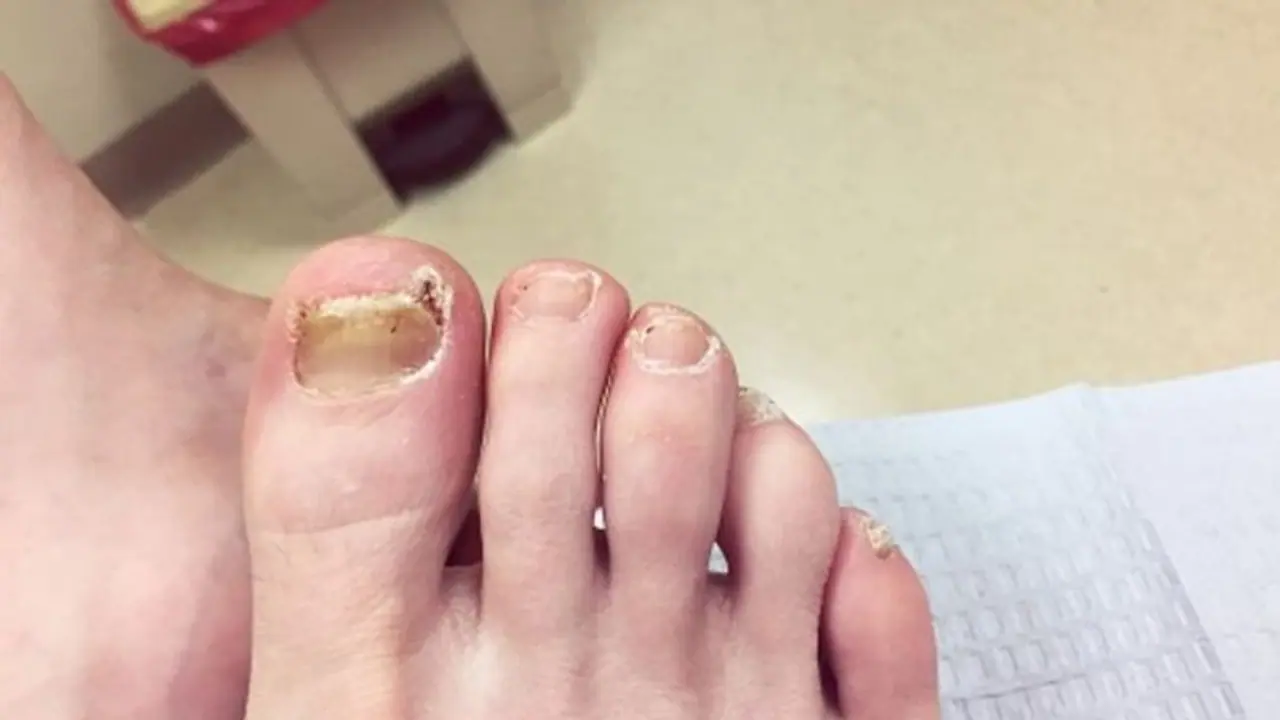 বৃষ্টি থেকে পায়ে দুর্গন্ধ ও চুলকুনি থেকে বাঁচতে রইল ৫ টোটকা বৃষ্টি থেকে পায়ে দুর্গন্ধ ও চুলকুনি থেকে বাঁচতে রইল ৫ টোটকা