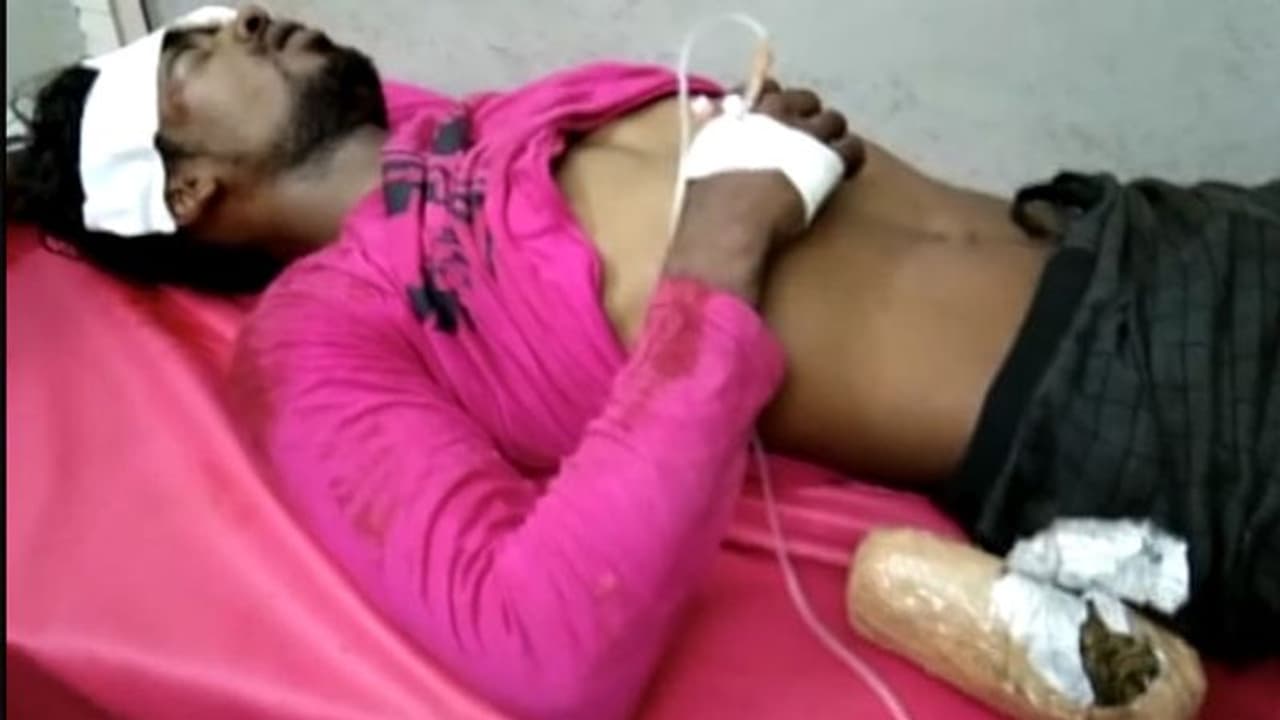 വാഹനാപകടത്തിൽ പരിക്കേറ്റ ആളിൽ നിന്നും കഞ്ചാവ് കണ്ടെടുത്തു വാഹനാപകടത്തിൽ പരിക്കേറ്റ ആളിൽ നിന്നും കഞ്ചാവ് കണ്ടെടുത്തു