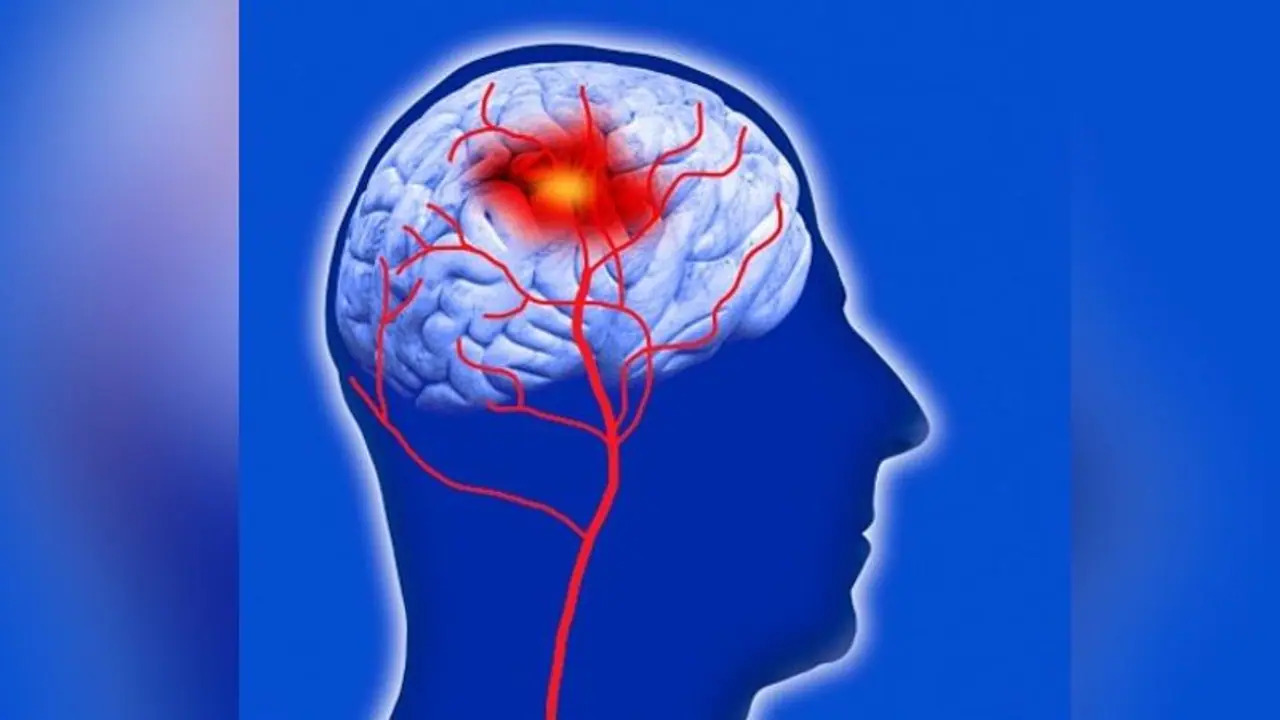 Did you know more screen time can push you closer to stroke risk? Here's what study reveals