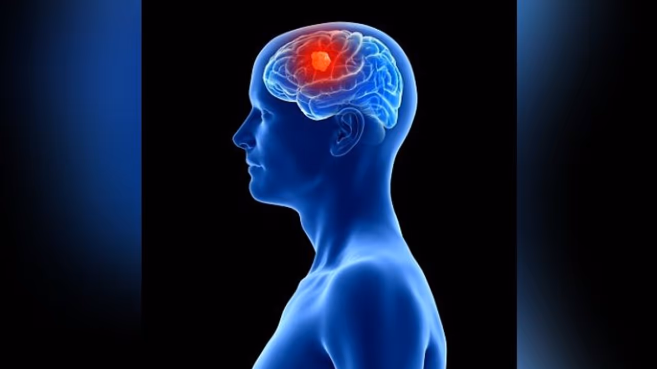 আপনার এই অভ্যেসই বাড়িয়ে দিচ্ছে ব্রেন টিউমরের ঝুঁকি আপনার এই অভ্যেসই বাড়িয়ে দিচ্ছে ব্রেন টিউমরের ঝুঁকি