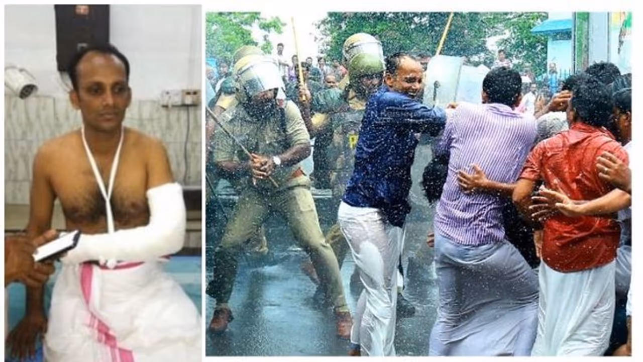 'ഇത്രയും മോശമായ പൊലീസിനെ ഇതുവരെ കണ്ടിട്ടില്ല'; രൂക്ഷവിമര്ശനവുമായി എല്ദോ എബ്രഹാം എംഎല്എ 'ഇത്രയും മോശമായ പൊലീസിനെ ഇതുവരെ കണ്ടിട്ടില്ല'; രൂക്ഷവിമര്ശനവുമായി എല്ദോ എബ്രഹാം എംഎല്എ