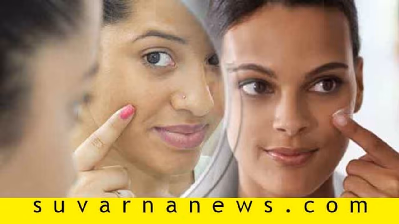 ವದನದ ಕಲೆಗೆ ಆಲೂ ರಸವೆಂಬ ಸೌಂದರ್ಯ ವರ್ಧಕ! ವದನದ ಕಲೆಗೆ ಆಲೂ ರಸವೆಂಬ ಸೌಂದರ್ಯ ವರ್ಧಕ!