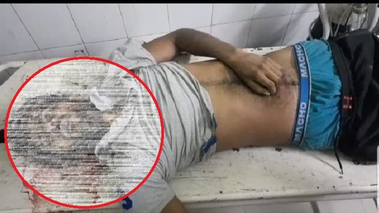 50 हजार का ईनामी बदमाश पुलिस मुठभेड़ में हुआ ढेर