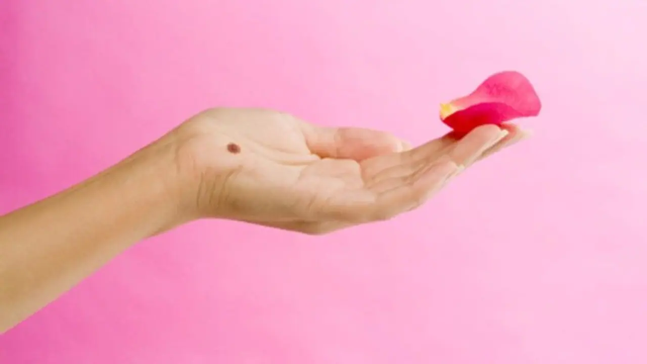 হাতের তালুতে তিল রয়েছে! সেটি শুভ না অশুভ