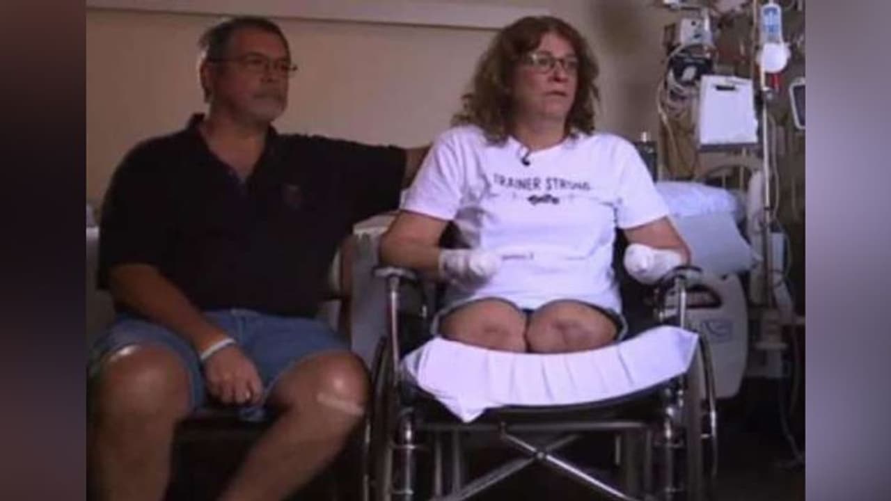 पालतू कुत्ते को करती थी KISS, खौफनाक वजह से कटवाने पड़े हाथ पैर पालतू कुत्ते को करती थी KISS, खौफनाक वजह से कटवाने पड़े हाथ पैर