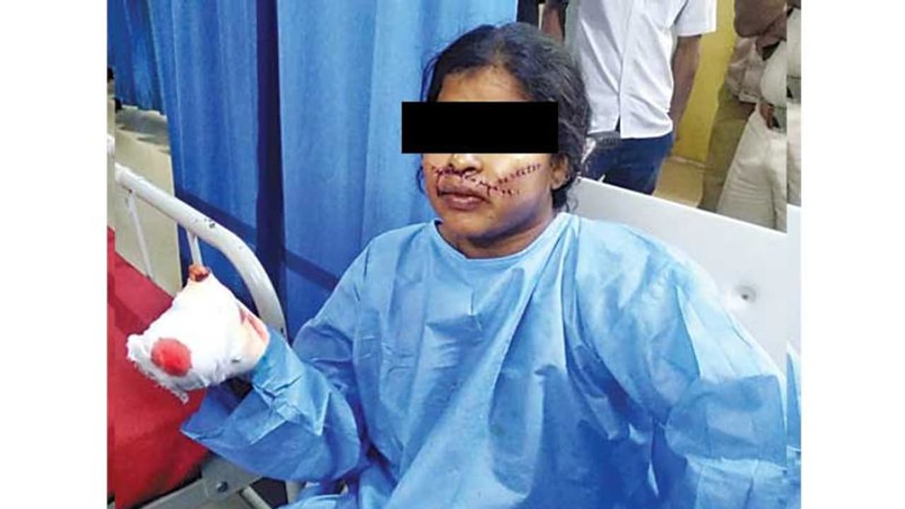 ಮೇಟಿ ಸೀಡಿ ಹಗರಣದ ಆರೋಪಿಗೆ ಮಾರಣಾಂತಿಕ ಹಲ್ಲೆ! ಮೇಟಿ ಸೀಡಿ ಹಗರಣದ ಆರೋಪಿಗೆ ಮಾರಣಾಂತಿಕ ಹಲ್ಲೆ!