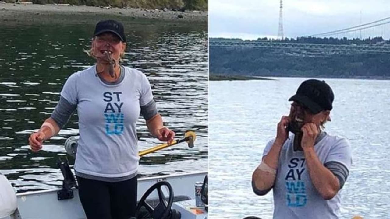 ഫോട്ടോ എടുക്കാന്‍ മുഖത്തുവെച്ച നീരാളി ആക്രമിച്ചു; പ്രതികാരം ചെയ്ത് യുവതി...