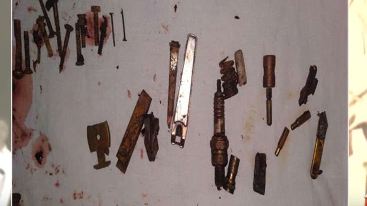 श्वांस नली में फंसी हुई थी पिन, डॉक्टरों ने बताई पीछे की शॉकिंग कहानी श्वांस नली में फंसी हुई थी पिन, डॉक्टरों ने बताई पीछे की शॉकिंग कहानी