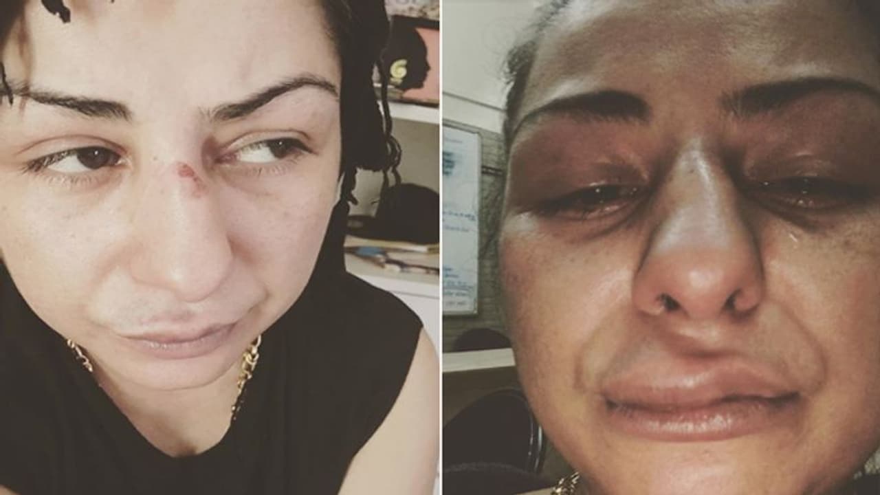 मोदी को अपशब्द कहने वाली सिंगर की पिटाई, जानें क्या है इस वायरल फोटो की हकीकत मोदी को अपशब्द कहने वाली सिंगर की पिटाई, जानें क्या है इस वायरल फोटो की हकीकत