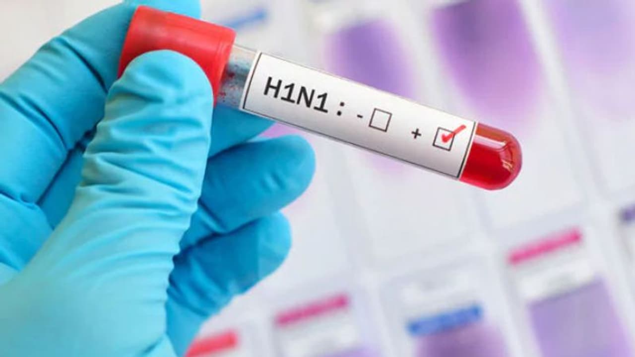 ಬೆಂಗಳೂರಲ್ಲಿ ವೈದ್ಯಗೇ ಮಾರಕ ಹಂದಿಜ್ವರ ಸೋಂಕು!