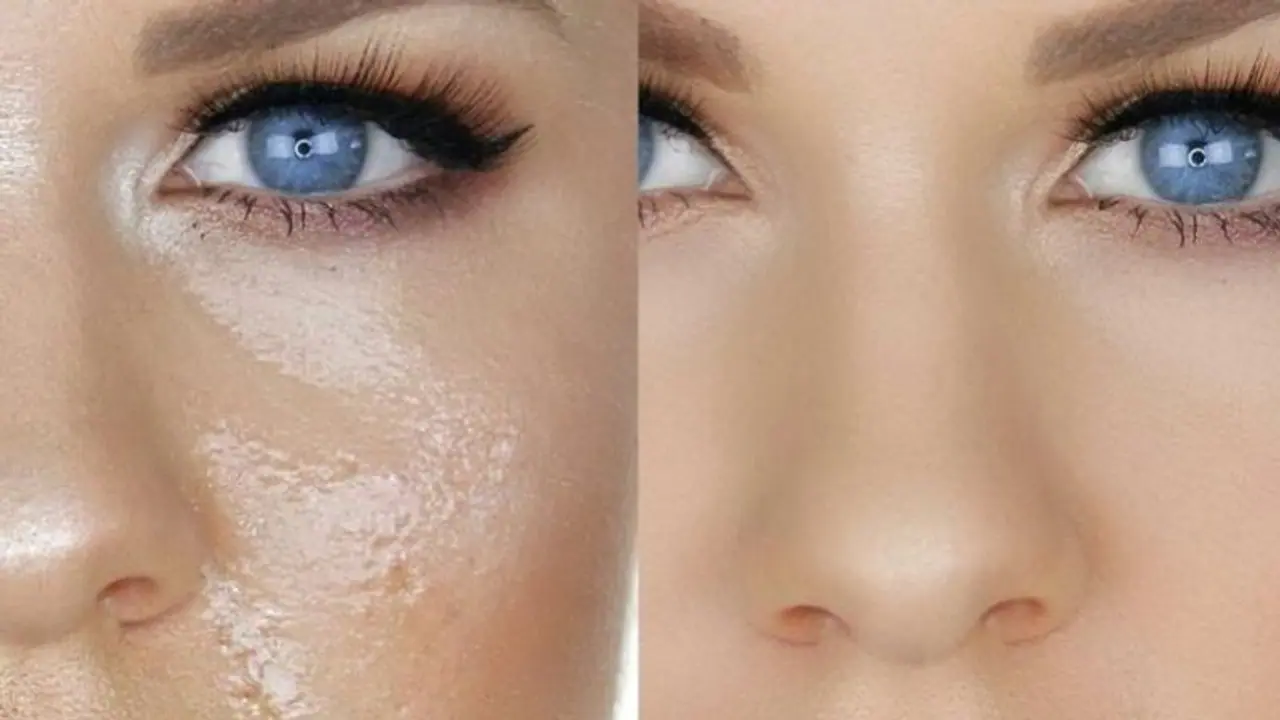 নিয়ন্ত্রণে রাখুন ত্বকের অতিরিক্ত তেল, অয়েলি স্কিনের নব্বই শতাংশ সমস্যা চলে যাবে নিয়ন্ত্রণে রাখুন ত্বকের অতিরিক্ত তেল, অয়েলি স্কিনের নব্বই শতাংশ সমস্যা চলে যাবে