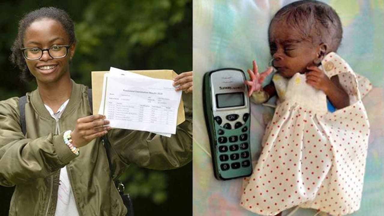 പിറന്നുവീണപ്പോൾ ഒരു മൊബൈൽ ഫോണിന്റെ അത്ര മാത്രം വലിപ്പം; ഈ മിടുക്കിയാണ് ഇപ്പോഴത്തെ താരം