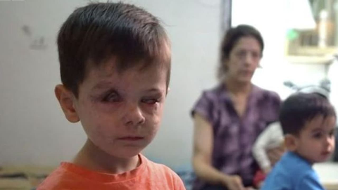 ജൗമ, യുദ്ധം വികൃതമാക്കിയ ഒരു കുരുന്നു മുഖം ജൗമ, യുദ്ധം വികൃതമാക്കിയ ഒരു കുരുന്നു മുഖം