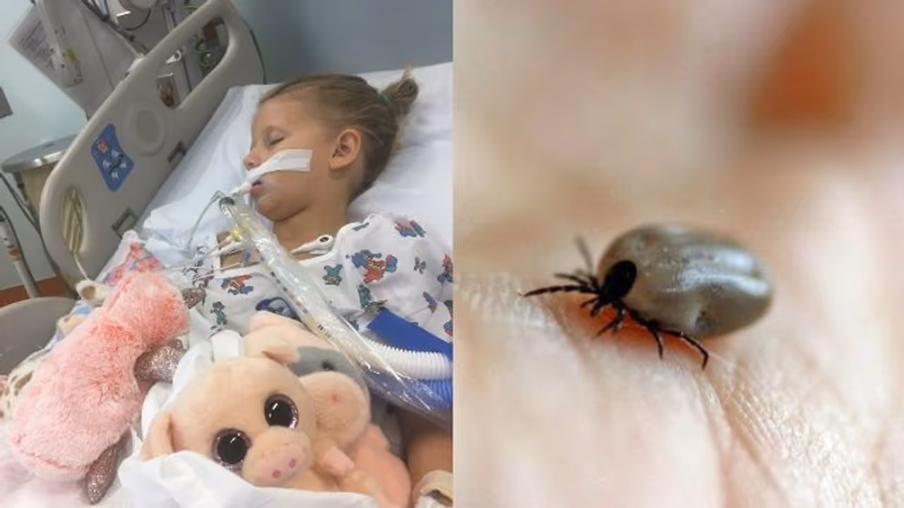 അഞ്ച് വയസ്സുകാരിയുടെ ജീവന് ഭീഷണിയായത് തലയിലെ പേന്‍ !