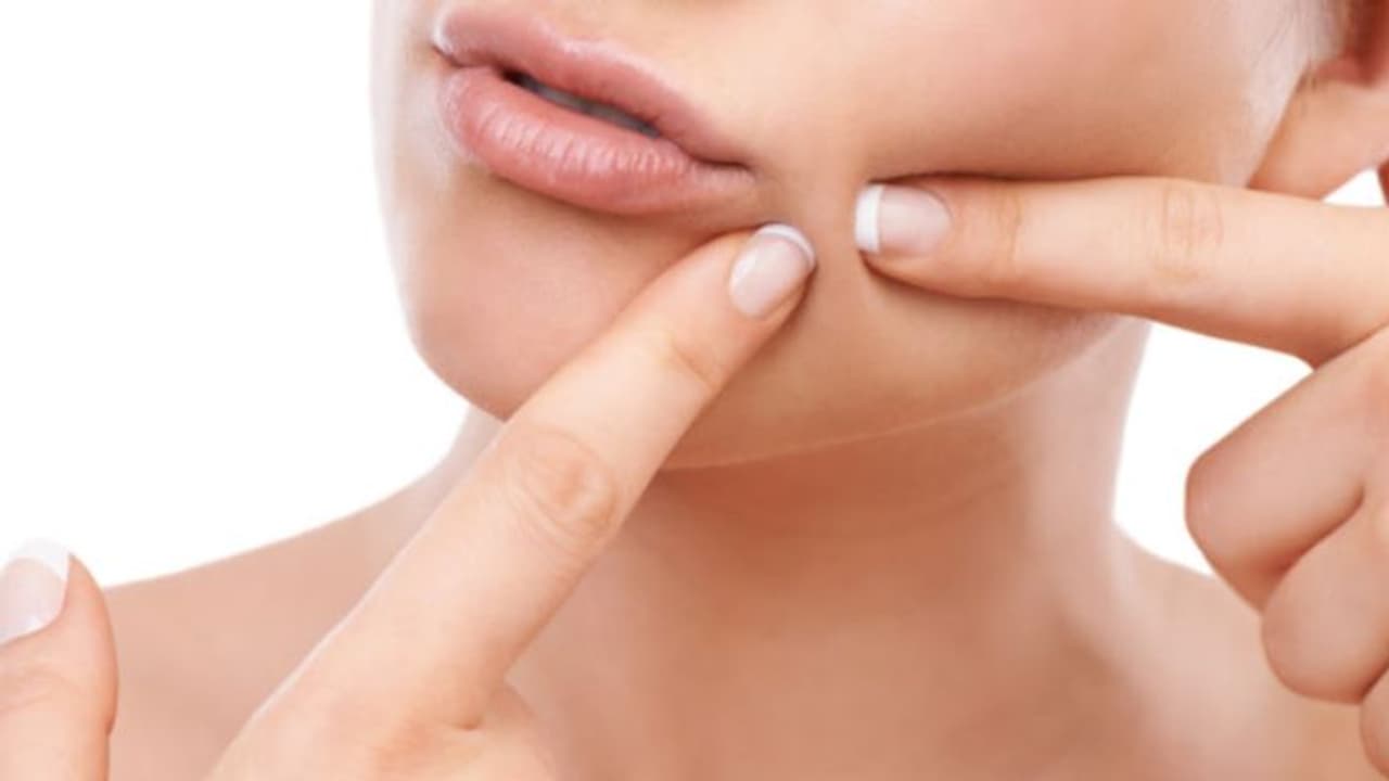 മുഖത്ത് കുരു വന്നാല്‍ ഉടനടി അത് പൊട്ടിച്ചുകളയാന്‍ തോന്നാറുണ്ടോ?