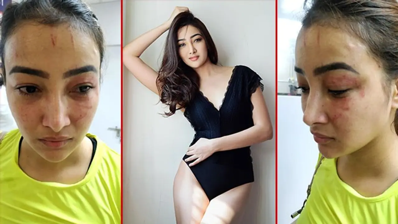 Actress brutally bashed by roommate; says she wanted to destroy my face Actress brutally bashed by roommate; says she wanted to destroy my face