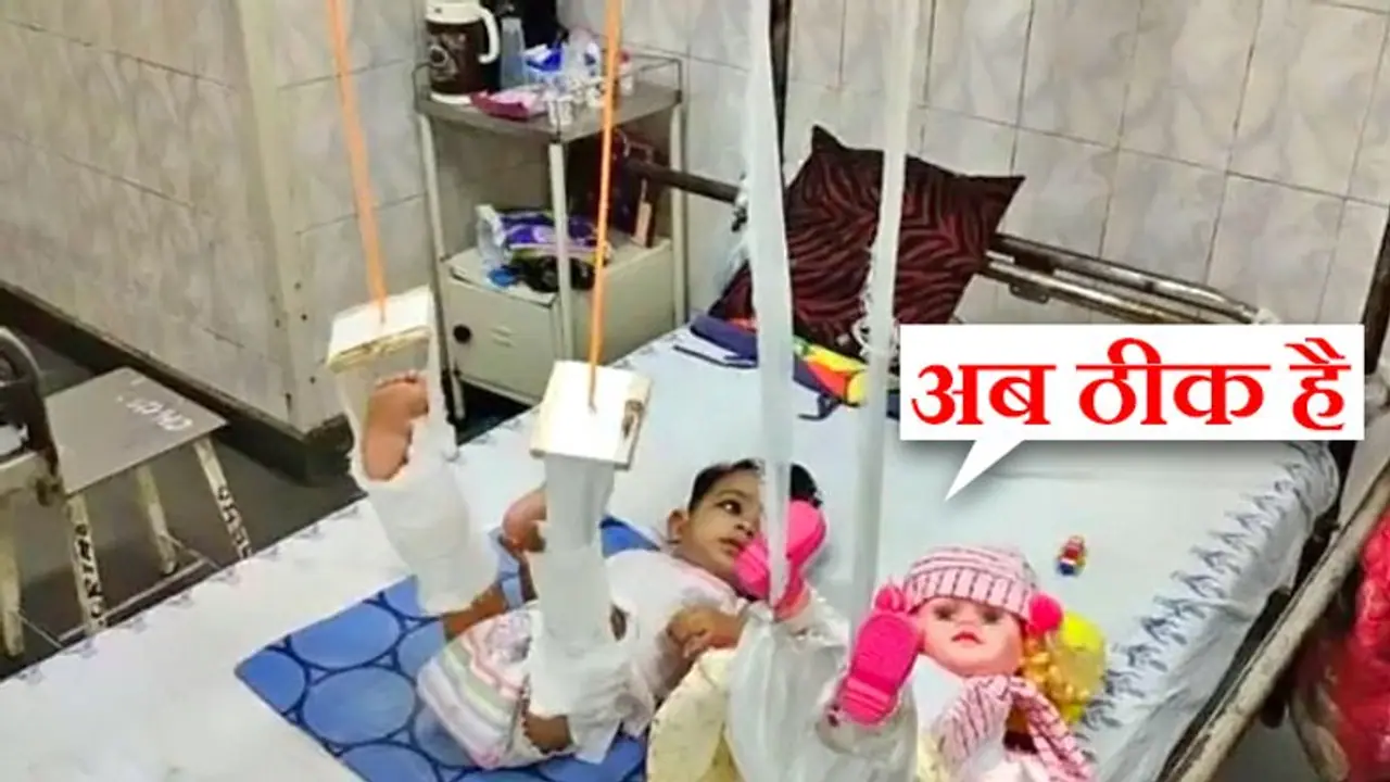 दर्द से कराह रही 11 महीने की बच्ची ने पकड़ी जिद पहले गुड़िया को प्लास्टर चढ़ाओ, बाद में हमें