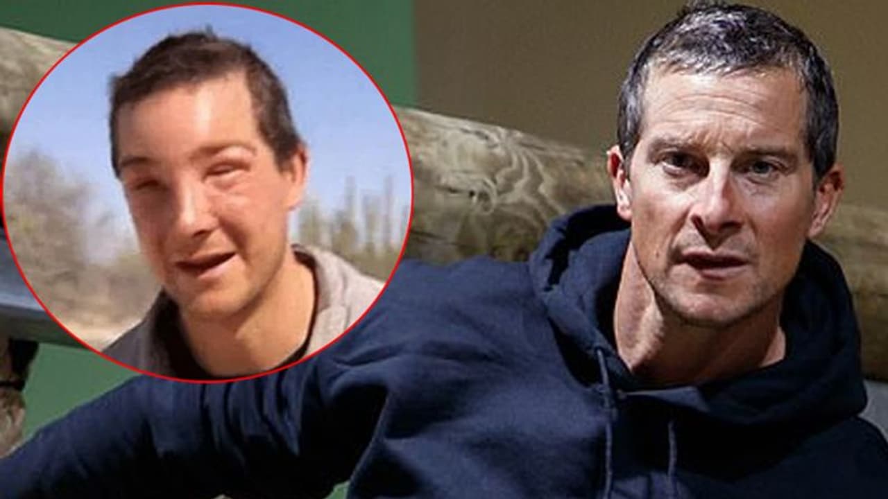 मैन VS वाइल्ड के बियर ग्रिल्स की हो गई ऐसी हालत, मोदी के साथ भी दिख चुके हैं मैन VS वाइल्ड के बियर ग्रिल्स की हो गई ऐसी हालत, मोदी के साथ भी दिख चुके हैं