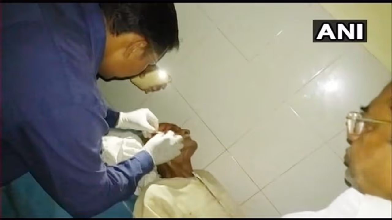 मोबाइल की लाइट में लगाए मरीज को टांके, सरकारी अस्पताल की खुली पोल