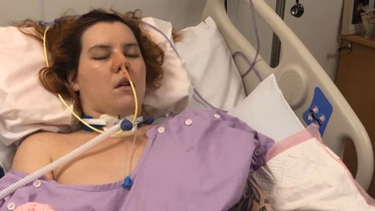 प्रेग्नेंसी में अचानक हुआ तेज सिरदर्द, डॉक्टर्स को इस हाल में निकालना पड़ा बच्चा