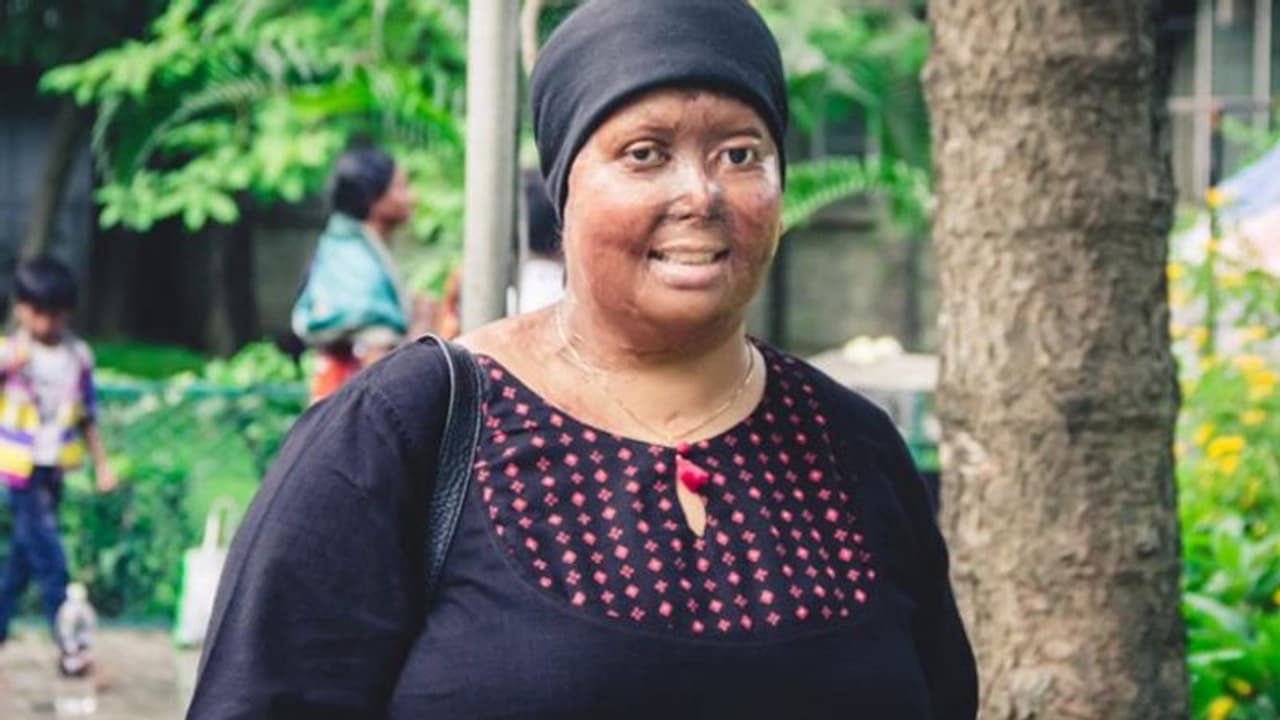 प्रेमी ने शादी के 12 दिन बाद कर दिया था ऐसा हाल, आज बनी प्रेरणा की मिसाल