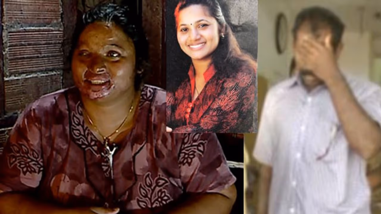 'കണ്ണുകൾ നഷ്ടമായി, വരുമാനം മുടങ്ങി'; വേദനകൾ കടിച്ചമർത്തി ആസിഡ് ആക്രമണത്തെ അതിജീവിച്ച റിൻസി 'കണ്ണുകൾ നഷ്ടമായി, വരുമാനം മുടങ്ങി'; വേദനകൾ കടിച്ചമർത്തി ആസിഡ് ആക്രമണത്തെ അതിജീവിച്ച റിൻസി