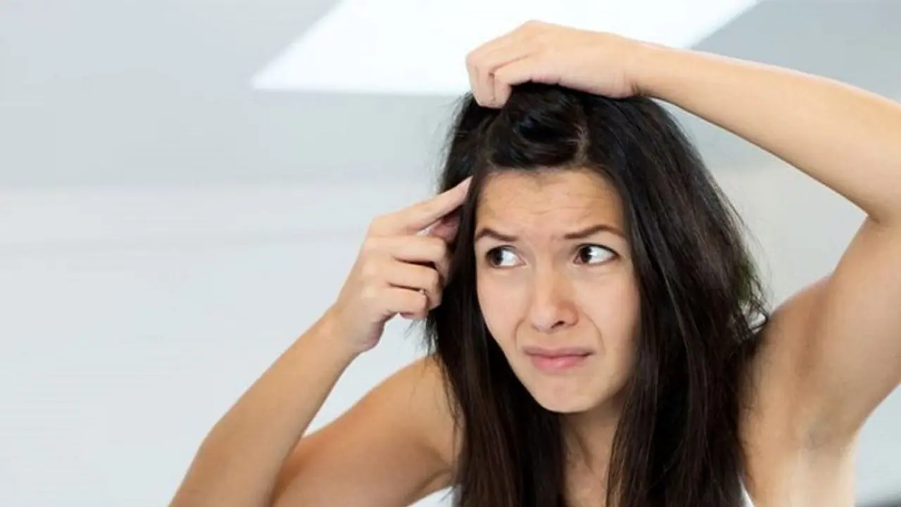 താരൻ അകറ്റാൻ ഇതാ 5 എളുപ്പ വഴികൾ