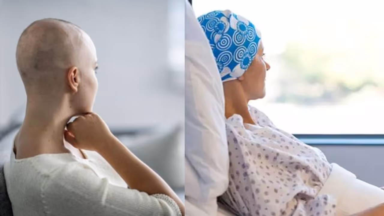 കീമോതെറാപ്പിക്ക് ശേഷമുളള തലമുടികൊഴിച്ചില് തടയാം; പുതിയ കണ്ടെത്തലുമായി ഗവേഷകര് കീമോതെറാപ്പിക്ക് ശേഷമുളള തലമുടികൊഴിച്ചില് തടയാം; പുതിയ കണ്ടെത്തലുമായി ഗവേഷകര്