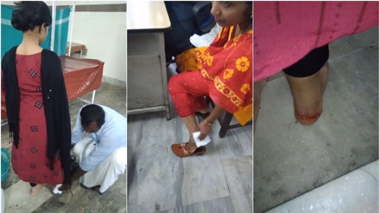 ആലപ്പുഴയില് 36 പേരെ കടിച്ച തെരുവ് നായകളില് ഒന്നിന് പേവിഷബാധ ആലപ്പുഴയില് 36 പേരെ കടിച്ച തെരുവ് നായകളില് ഒന്നിന് പേവിഷബാധ