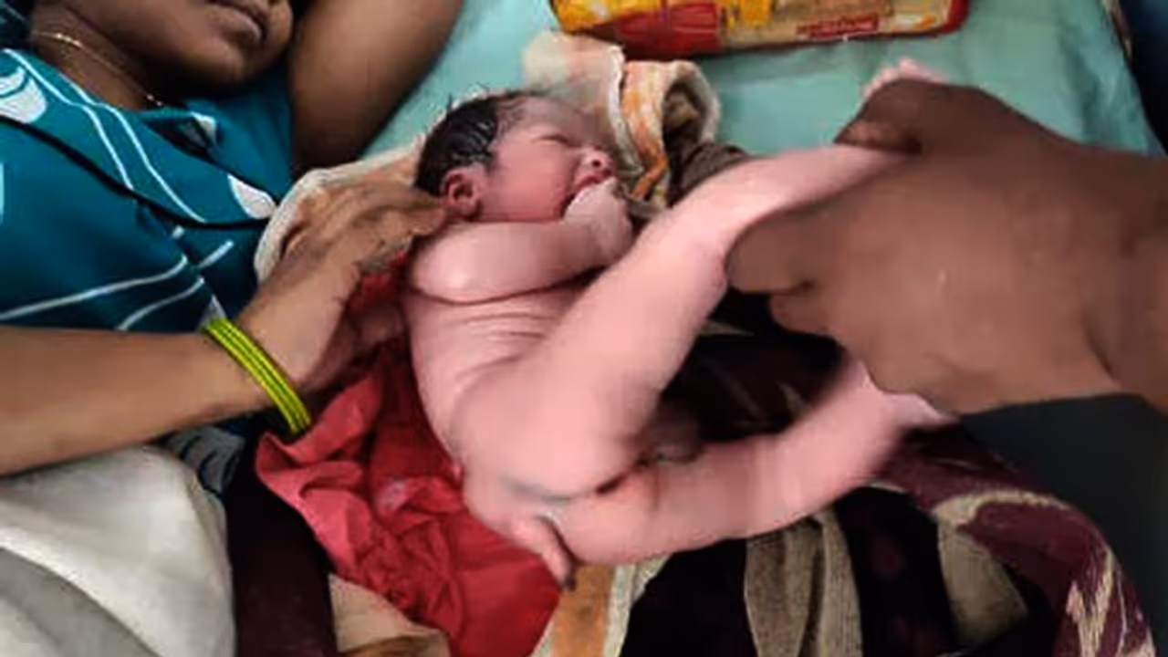 महिला ने दिया ऐसे बच्चे को जन्म कि अस्पताल में लग गई भीड़, सिर्फ 2 परसेंट में होता है ये महिला ने दिया ऐसे बच्चे को जन्म कि अस्पताल में लग गई भीड़, सिर्फ 2 परसेंट में होता है ये