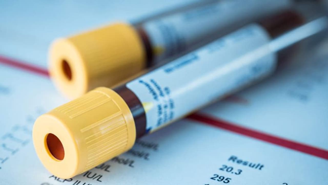 രക്തപരിശോധനയിലൂടെ 20 തരം ക്യാൻസറുകൾ കണ്ടെത്താനാകുമെന്ന് ഗവേഷകര് രക്തപരിശോധനയിലൂടെ 20 തരം ക്യാൻസറുകൾ കണ്ടെത്താനാകുമെന്ന് ഗവേഷകര്